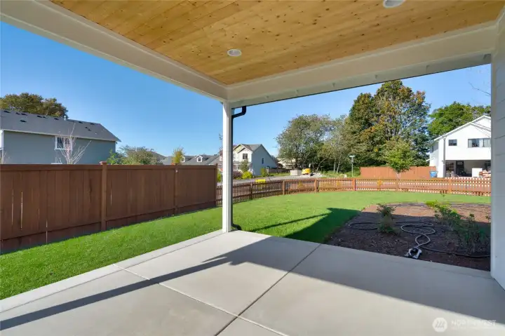 Lot 21 - Covered Patio