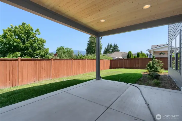 Covered outdoor patio -  Pics are of a different 2601 Hattie plan home. Features and colors may differ.