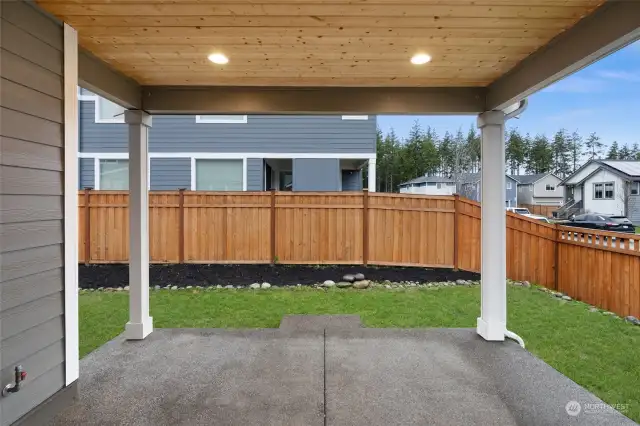 Chic Patio: Features a warm cedar ceiling, perfect for relaxing or entertaining outdoors.