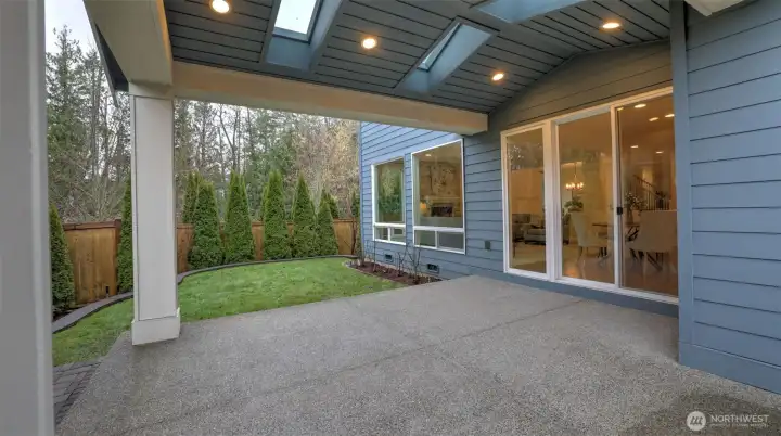 Includes recessed cans and skylights