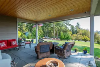 Larqge covered patio with build in lighting.