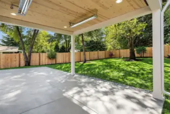 Private outdoor covered living area
