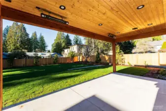 Outdoor living space